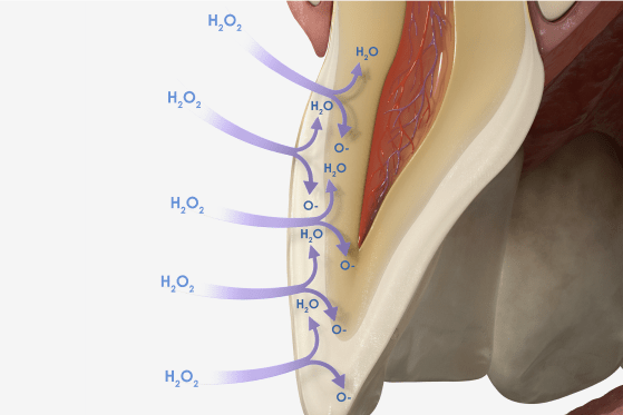 Abbildung eines Aufhellungsbeispiels